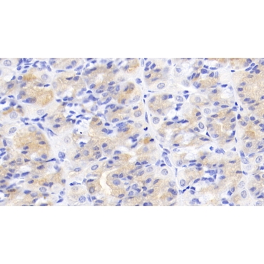 Activin A Receptor Type II A (ACVR2A) Human Monoclonal Antibody