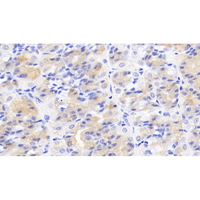 Activin A Receptor Type II A (ACVR2A) Human Monoclonal Antibody