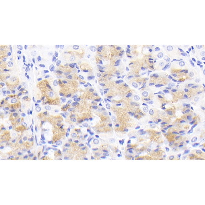 Activin A Receptor Type II A (ACVR2A) Human Monoclonal Antibody