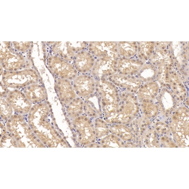 Activin A Receptor Type II A (ACVR2A) Human Monoclonal Antibody