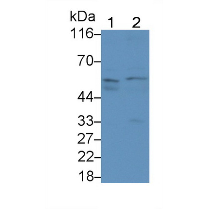 Activin A Receptor Type II A (ACVR2A) Human Monoclonal Antibody