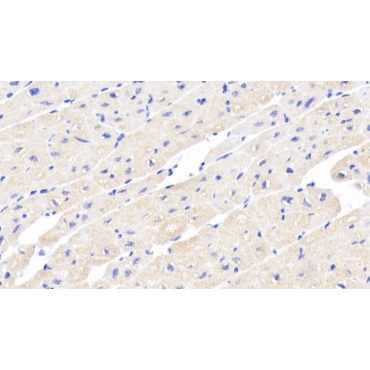 Activin A Receptor Type II A (ACVR2A) Human Monoclonal Antibody