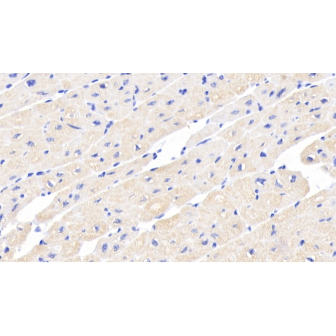 Activin A Receptor Type II A (ACVR2A) Human Monoclonal Antibody
