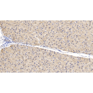SMAD family member 3 (SMAD3) Human Monoclonal Antibody