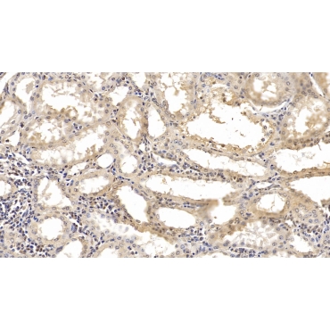 SMAD family member 3 (SMAD3) Human Monoclonal Antibody