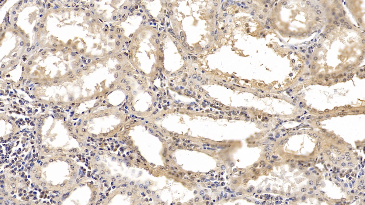 SMAD family member 3 (SMAD3) Human Monoclonal Antibody