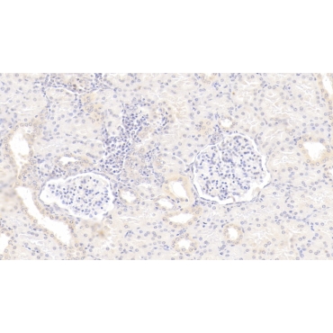 Gremlin 1 (GREM1) Human Monoclonal Antibody