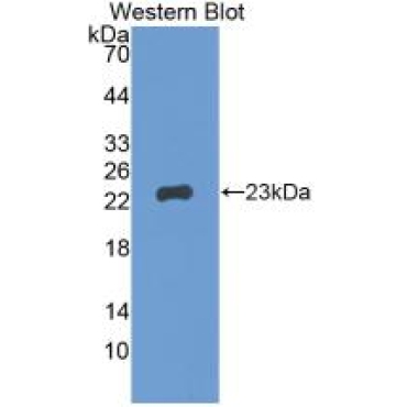 Gremlin 1 (GREM1) Human Monoclonal Antibody