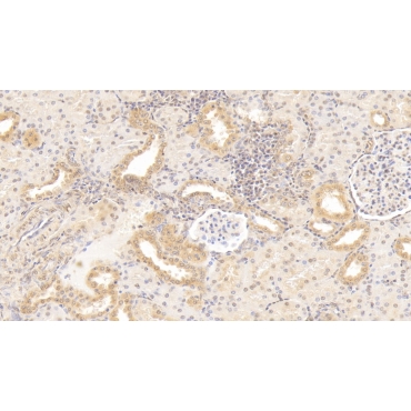 Gremlin 1 (GREM1) Human Monoclonal Antibody
