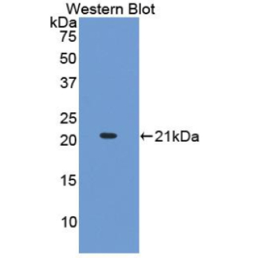 Collagen Type XV (COL15) Human Monoclonal Antibody