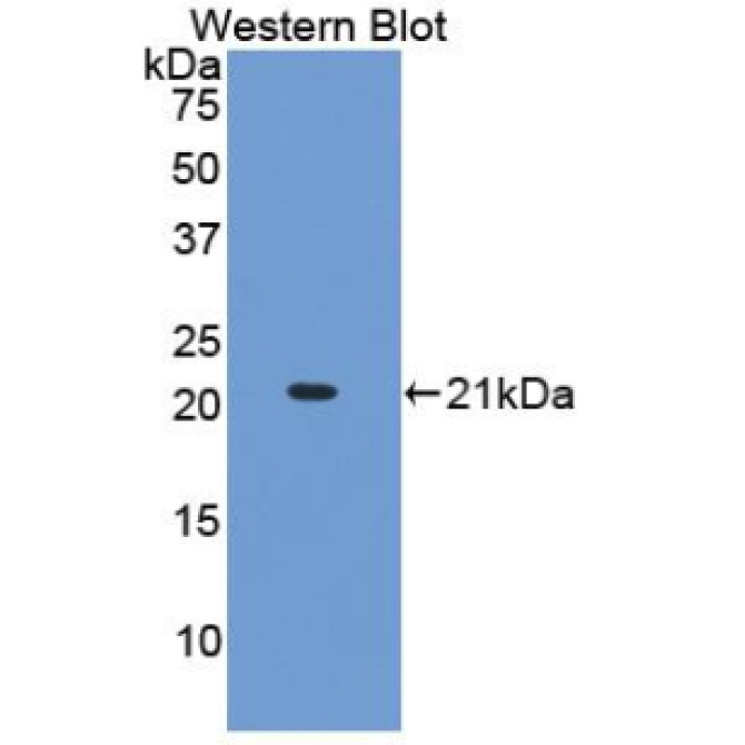 Collagen Type XV (COL15) Human Monoclonal Antibody