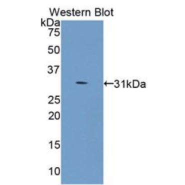 Collagen Type IV Alpha 5 (COL4a5) Human Monoclonal Antibody