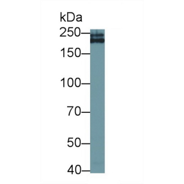 Collagen Type IV Alpha 3 (COL4a3) Human Monoclonal Antibody