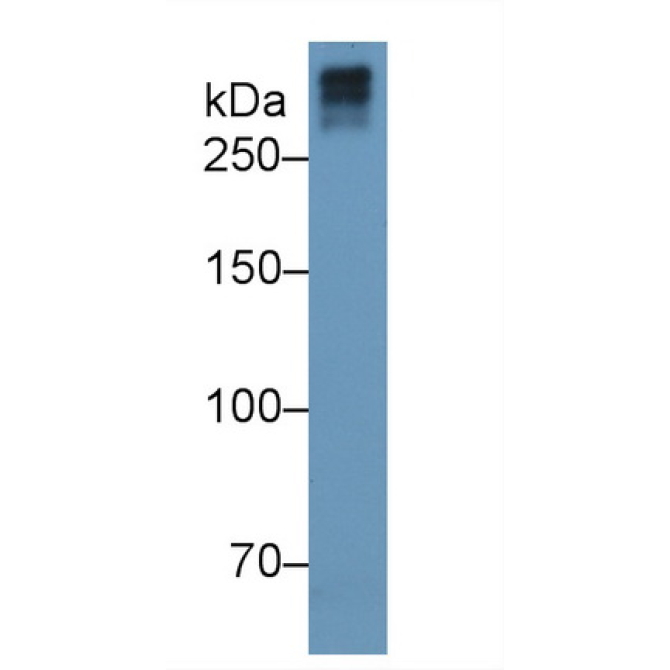 Collagen Type VII (COL7) Human Monoclonal Antibody