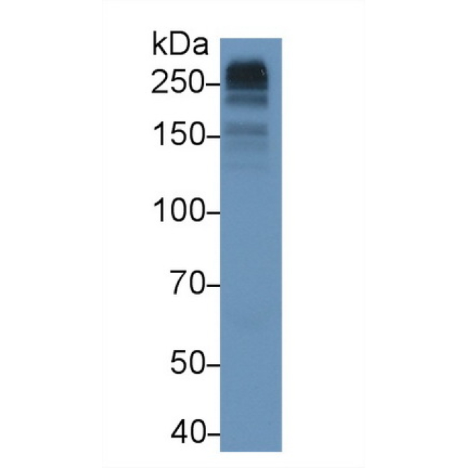 Collagen Type VII (COL7) Human Monoclonal Antibody