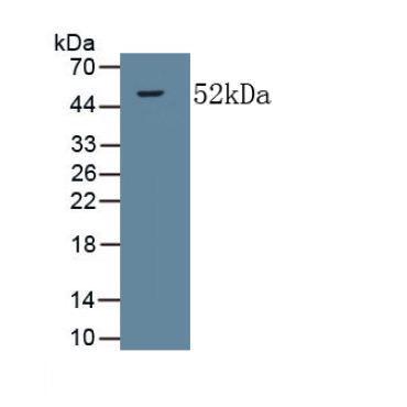 Collagen Type V Alpha 2 (COL5a2) Human Monoclonal Antibody