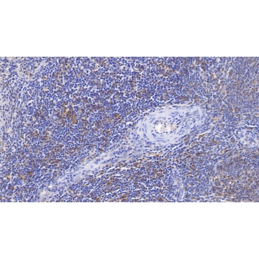 HLA Class II Histocompatibility Antigen, DRB1 Beta Chain (HLA-DRB1) Human Monoclonal Antibody
