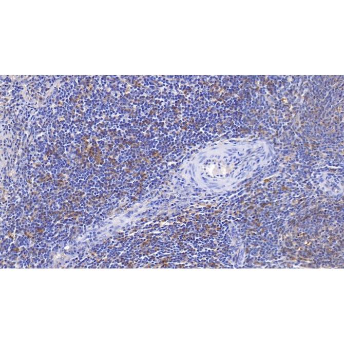 HLA Class II Histocompatibility Antigen, DRB1 Beta Chain (HLA-DRB1) Human Monoclonal Antibody