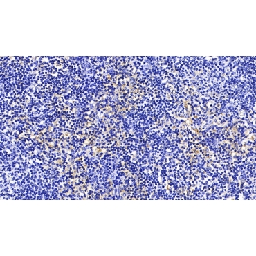 HLA Class II Histocompatibility Antigen, DRB1 Beta Chain (HLA-DRB1) Human Monoclonal Antibody