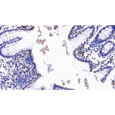 HLA Class II Histocompatibility Antigen, DRB1 Beta Chain (HLA-DRB1) Human Monoclonal Antibody