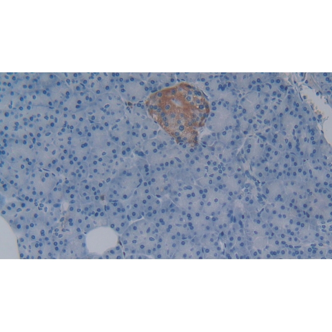 Left/Right Determination Factor 1 (LEFTY1) Human Monoclonal Antibody