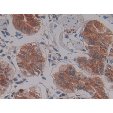 Left/Right Determination Factor 1 (LEFTY1) Human Monoclonal Antibody