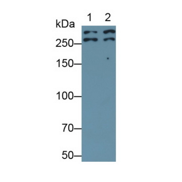 Desmoplakin (DSP) Human Monoclonal Antibody