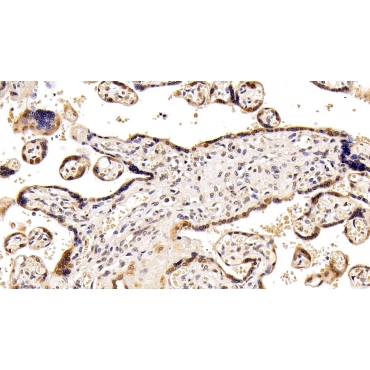 Histone Deacetylase 1 (HDAC1) Human Monoclonal Antibody