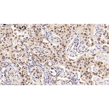 Histone Deacetylase 1 (HDAC1) Human Monoclonal Antibody