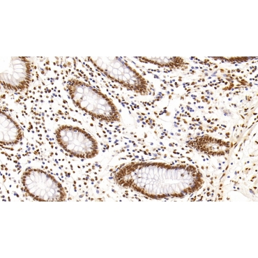 Histone Deacetylase 1 (HDAC1) Human Monoclonal Antibody