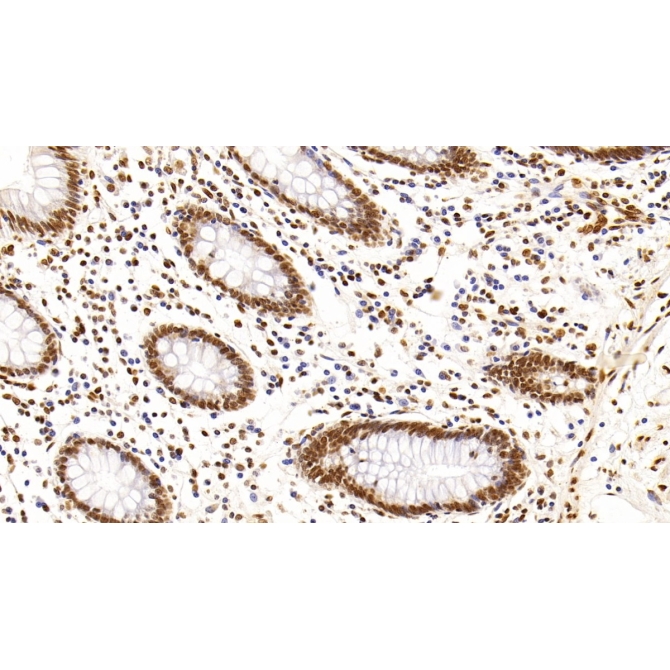 Histone Deacetylase 1 (HDAC1) Human Monoclonal Antibody