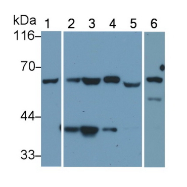 Histone Deacetylase 1 (HDAC1) Human Monoclonal Antibody