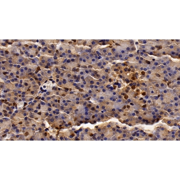 Histone Deacetylase 1 (HDAC1) Human Monoclonal Antibody