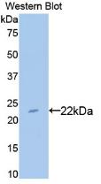 Bleomycin Hydrolase (BLMH) Rat Monoclonal Antibody