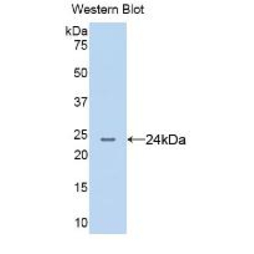 Anterior Gradient 2 (AGR2) Human Monoclonal Antibody