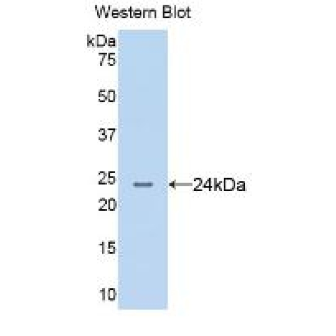 Anterior Gradient 2 (AGR2) Human Monoclonal Antibody