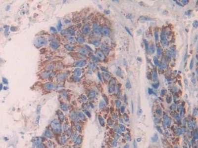 Anterior Gradient 2 (AGR2) Rat Monoclonal Antibody