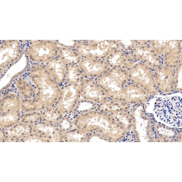 Ionized Calcium-binding Adapter Molecule 1 (IBA1) Human Monoclonal Antibody