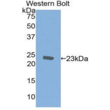 Ionized Calcium-binding Adapter Molecule 1 (IBA1) Human Monoclonal Antibody