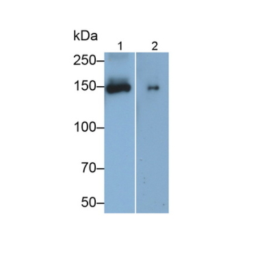 Angiomotin (AMOT) Human Monoclonal Antibody