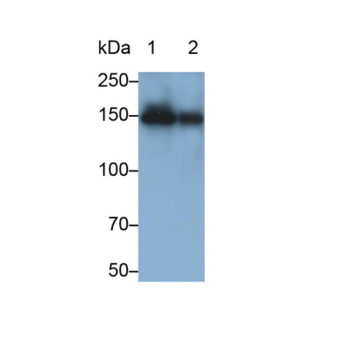 Angiomotin (AMOT) Human Monoclonal Antibody