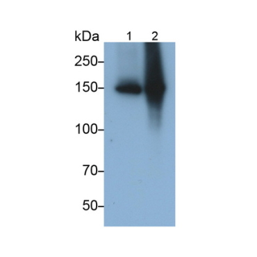 Angiomotin (AMOT) Human Monoclonal Antibody