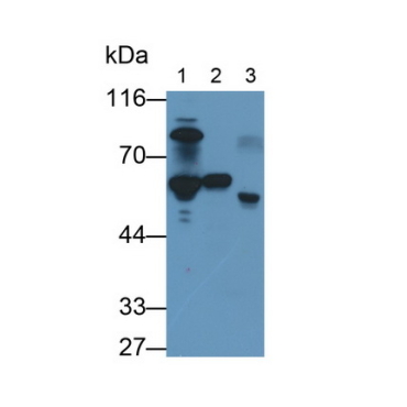 Antithrombin (AT) Human Monoclonal Antibody