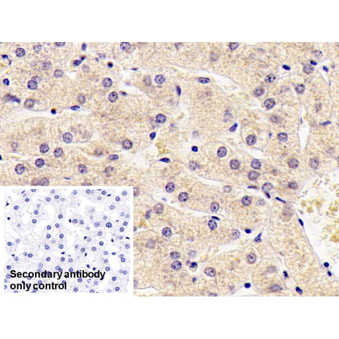 Antithrombin (AT) Human Monoclonal Antibody
