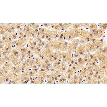Antithrombin (AT) Human Monoclonal Antibody