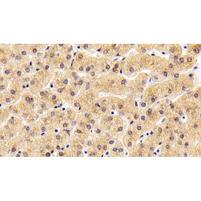 Antithrombin (AT) Human Monoclonal Antibody
