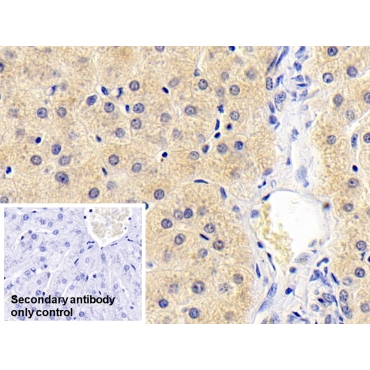 Antithrombin (AT) Human Monoclonal Antibody