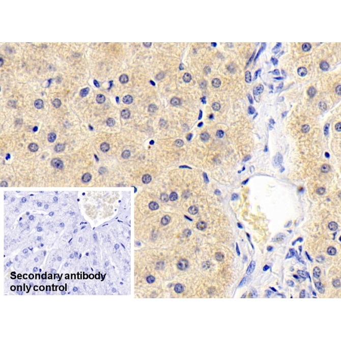 Antithrombin (AT) Human Monoclonal Antibody