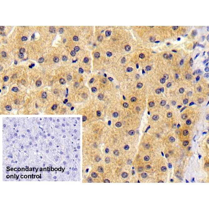 Antithrombin (AT) Human Monoclonal Antibody