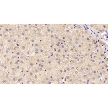 Antithrombin (AT) Human Monoclonal Antibody